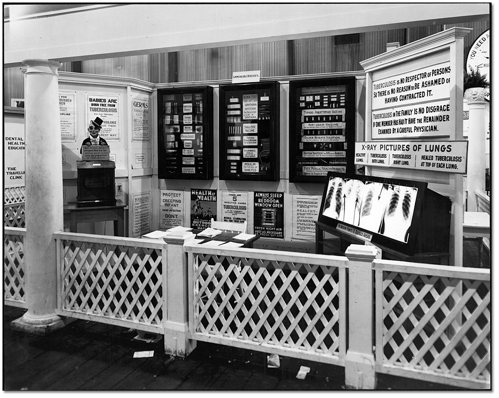 Photographie : Élément d'exposition sur la tuberculose, Exposition nationale canadienne, Toronto, [vers 1924]