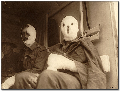 Photographie : Des blessés canadiens en route vers Blighty, [vers 1918]